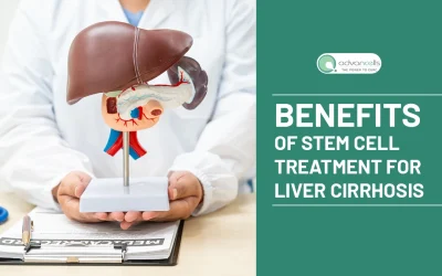 Benefits of Stem Cell Treatment for Liver Cirrhosis