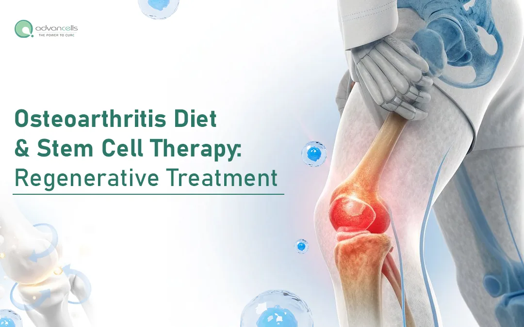 Osteoarthritis Diet & Stem Cell Therapy: Regenerative Treatment