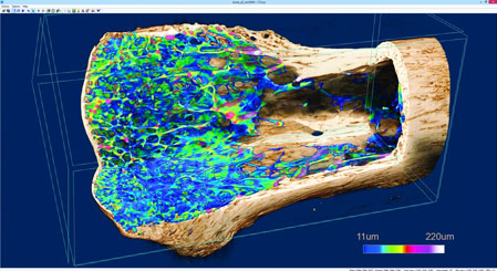 Micro-CT scan - bone