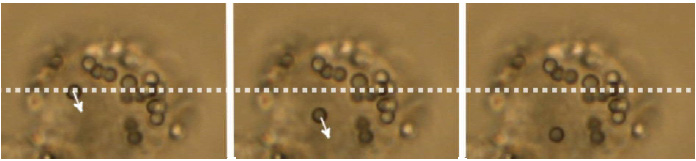 Intracellular-manipulation
