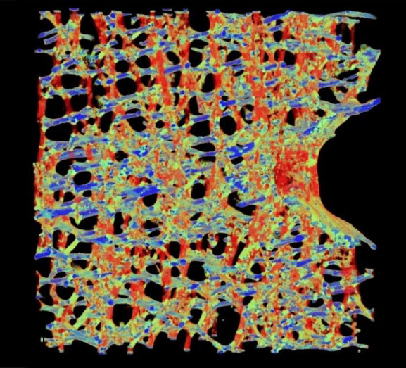 Local orientation mapping