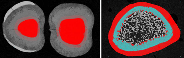 Micro-CT ROI subtraction using Bruker CTAn software