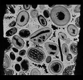 High resolution X-ray micro-CT