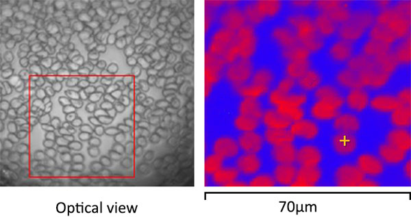 Red Blood Cells Example