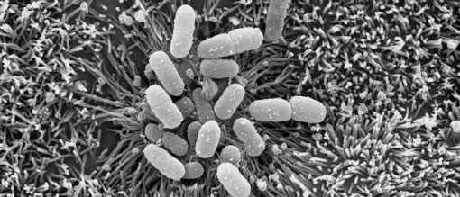 SEM Microscopy