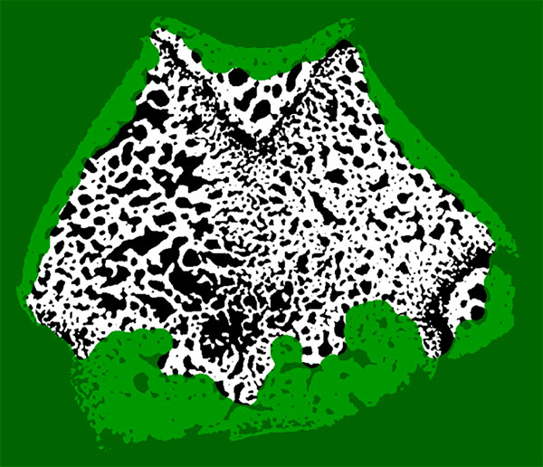 Trabecular Micro-CT