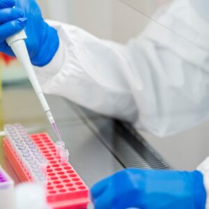 Test intolleranze alimentari