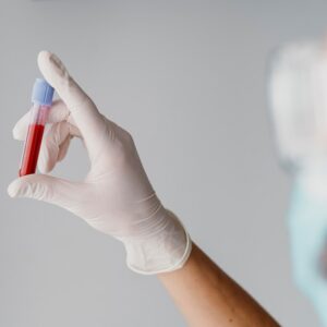 Test Celiachia (Anticorpi anti gliadina deamidata iga – igg)