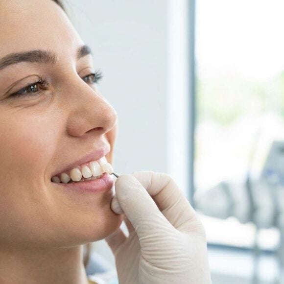 Best Filling Material for Front Tooth Cavity (2026)