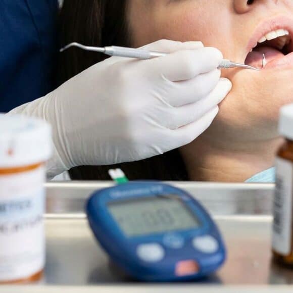 Gum Disease and Diabetes Treatment: 2026 Guide