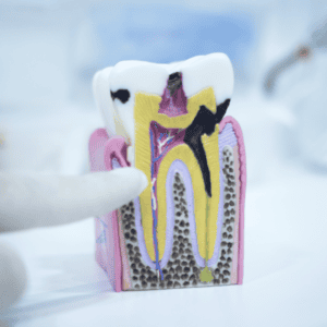 Brisbane City Dentist 