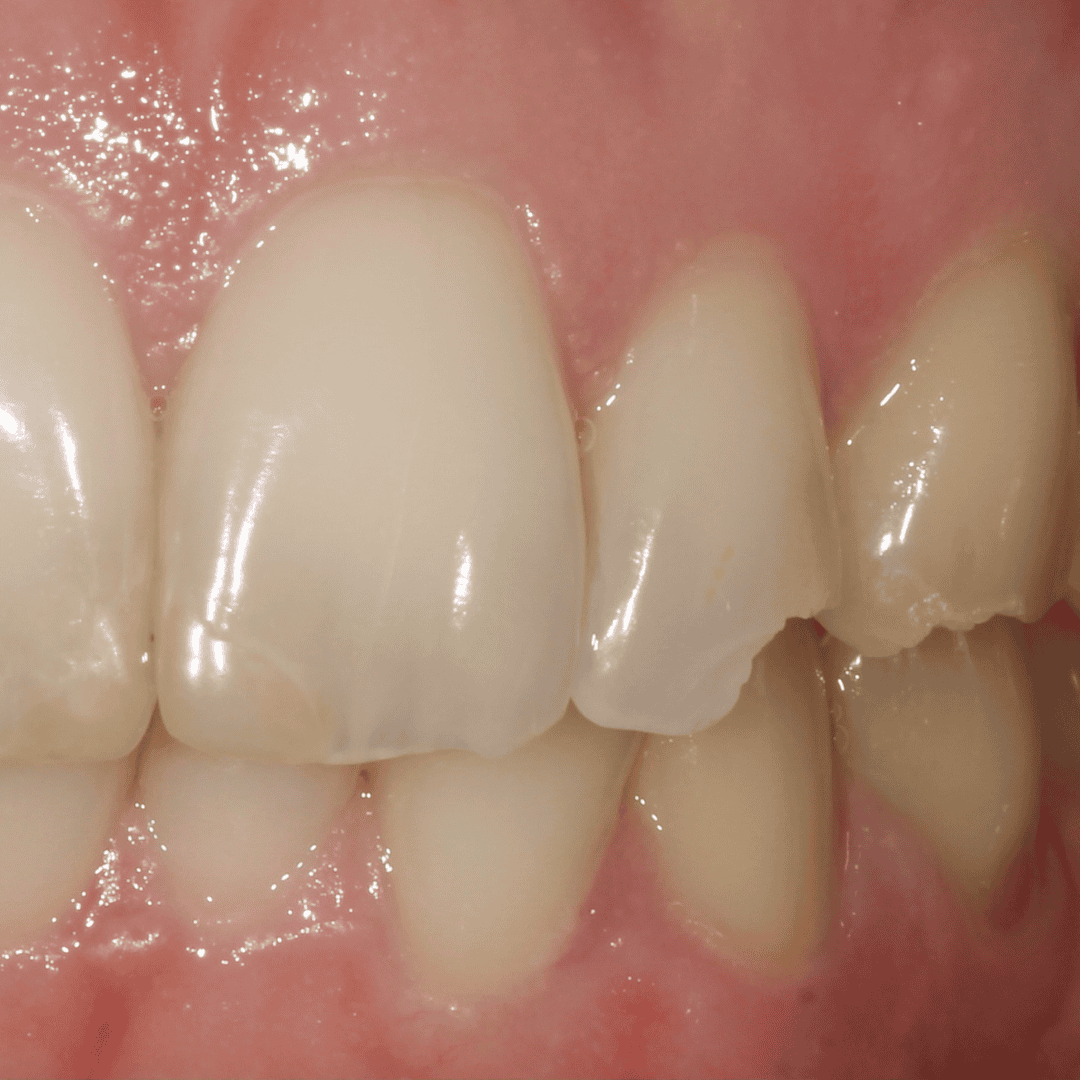 Dental emergency brisbane