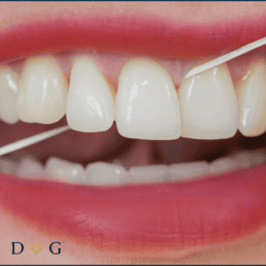 brisbane cbd dentist