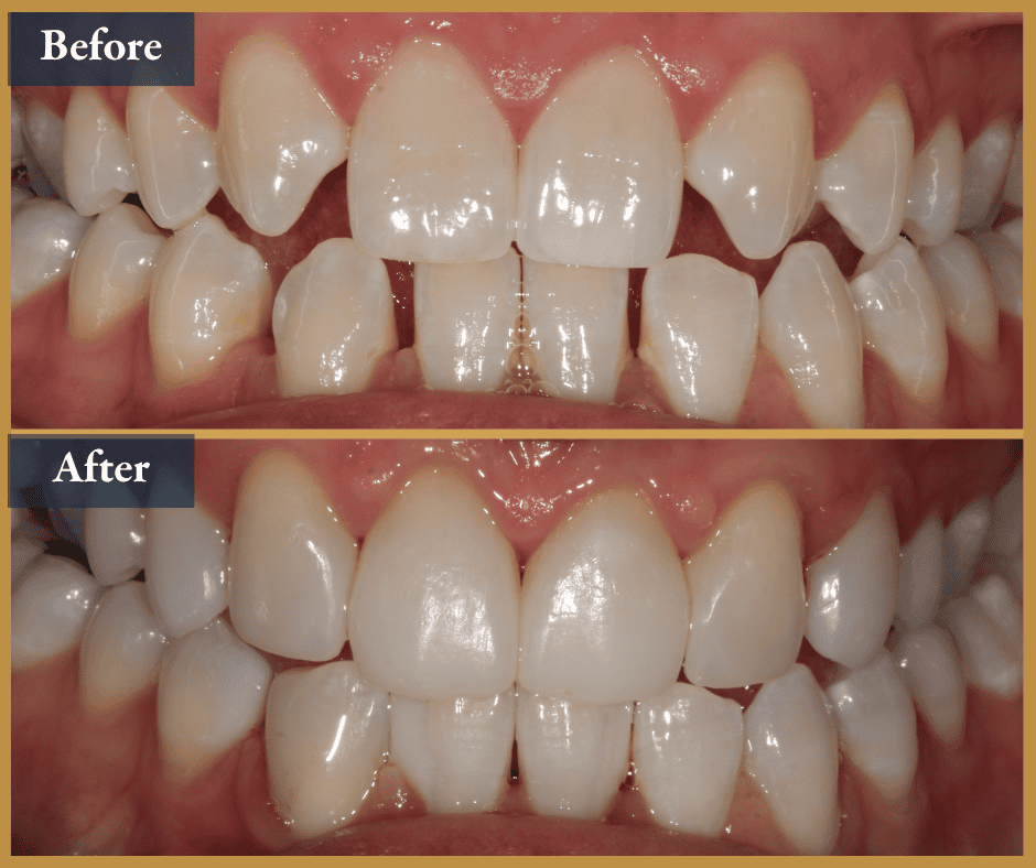 cosmetic dentist brisbane