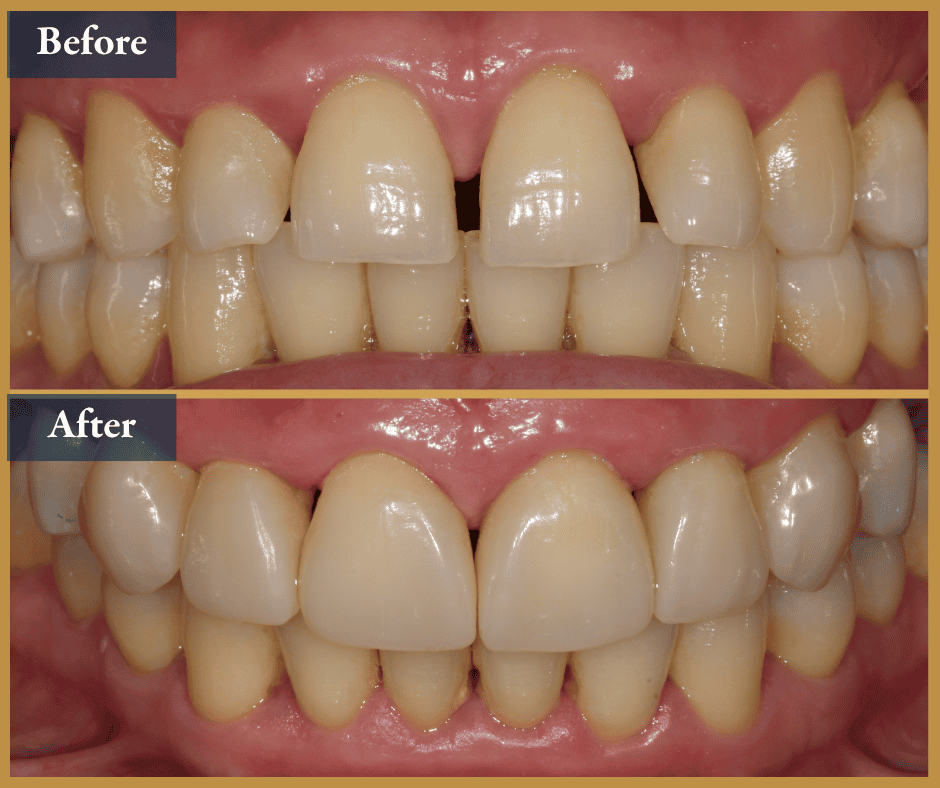 cosmetic dentist brisbane