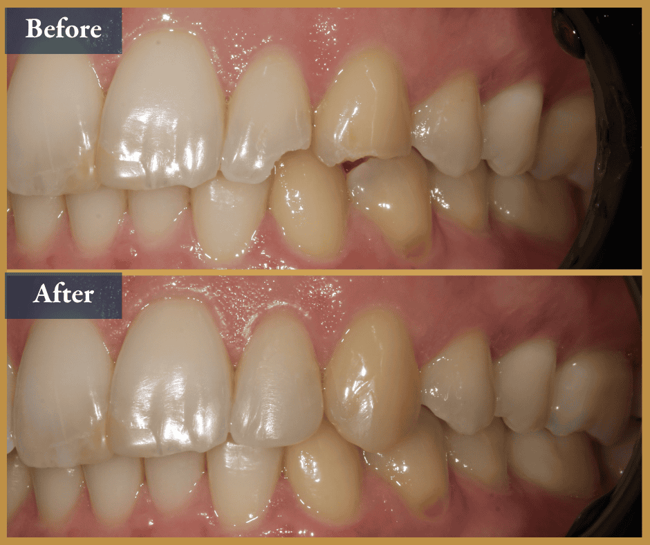 Cosmetic dentist brisbane