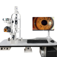 Digital Slit Lamp