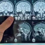 The doctor analyzes an MRI image of the brain.