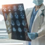 Alzheimer's research