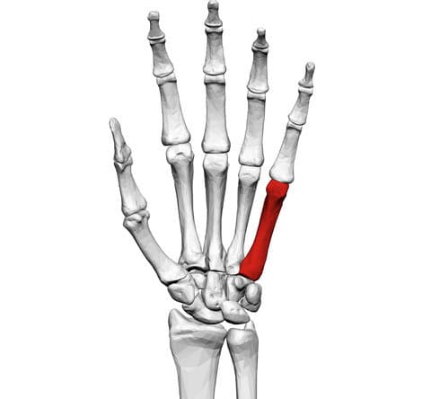 Fifth metacarpal of the left hand (shown in red). Palmar view.