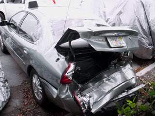 $65,000 Rotator Cuff (Shoulder) Surgery Full Thickness Tear Car Crash Orlando Florida