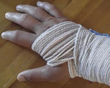 Bandage on hand after car crash