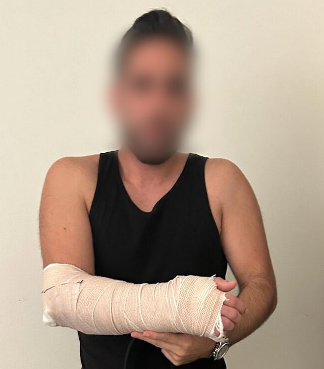 Client standing with his arm in a large white medical cast after sustaining a wrist fracture in a T-bone collision.