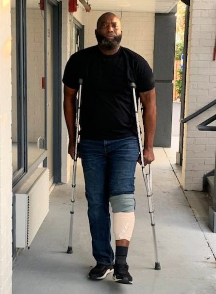 Mike walking on crutches with a bandaged leg, wearing jeans and a black t-shirt, showing how the dog bite injury affected his mobility.
