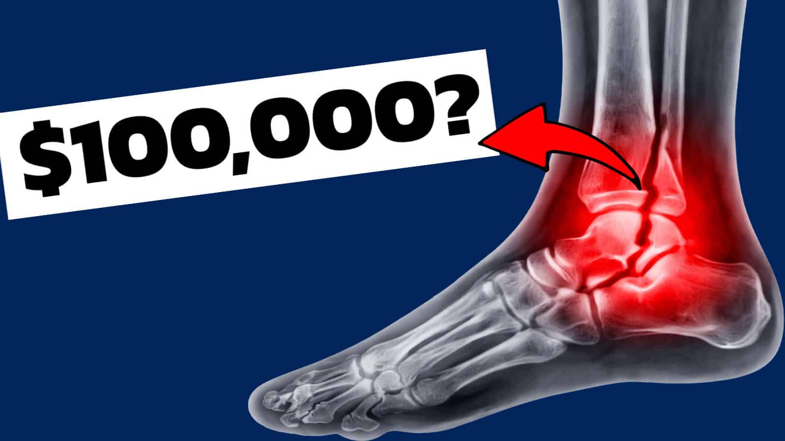 broken ankle $100,000?