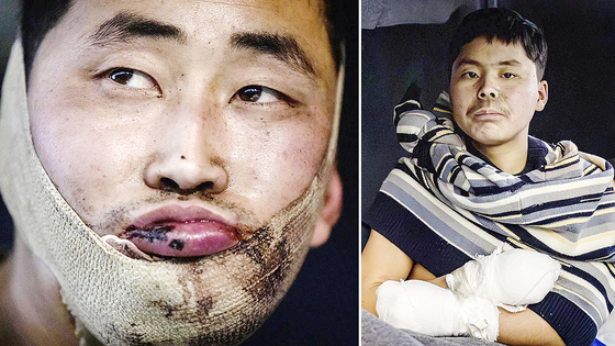 North Korean soldiers are seen in a post uploaded on X by Ukrainian President Volodymyr Zelensky. [SCREEN CAPTURE]