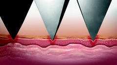 Nahaufnahme der Hautbehandlung mit Mezotix im Kosmetikstudio Elberfeld.