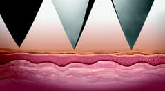 Nahaufnahme der Hautbehandlung mit Mezotix im Kosmetikstudio Elberfeld.