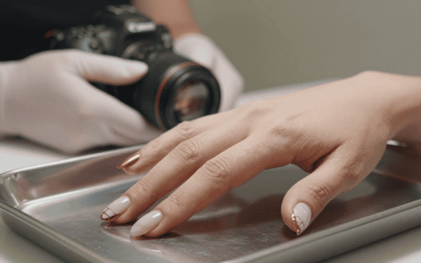Manucure médicale : l&rsquo;alarme des dermatologues sur cette mode virale