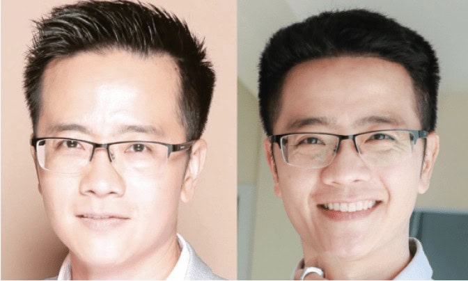 รีวิวผลลัพธ์การปลูกผมถาวรของผู้ประกาศข่าวชายช่อง 3