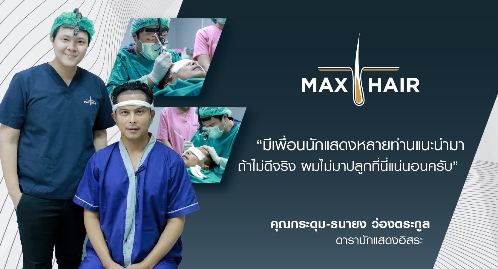 รีวิวปลูกผม คุณกระดุม ธนายง ว่องตระกูล (ดารานักแสดง) (2)