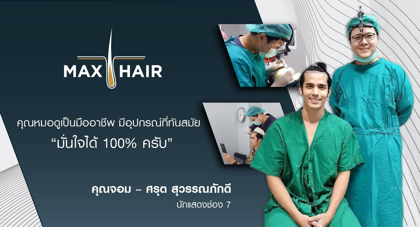 รีวิวปลูกผม คุณจอม ศรุต สุวรรณภักดี (นักแสดงช่อง7) (1)