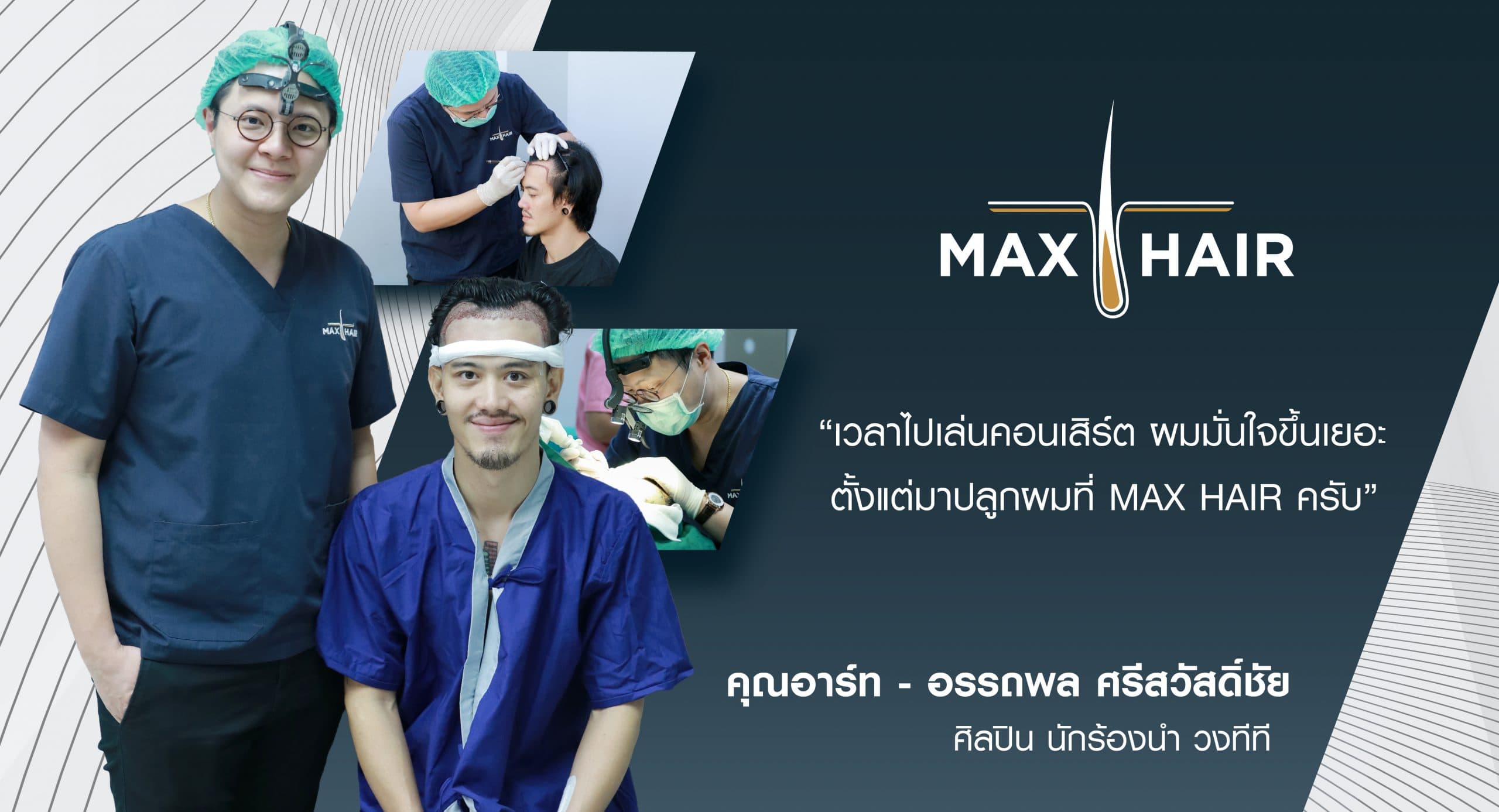 รวมรีวิวปลูกผม คุณทาร์ท อรรถพล ศรีสวัสดิ์