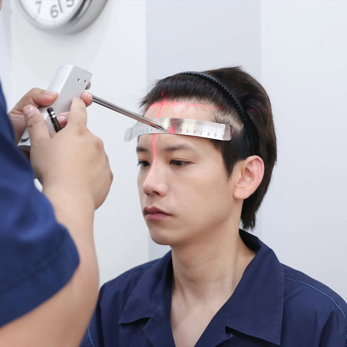รีวิวปลูกผมผู้ชาย เทคนิค MCG 2,500 กราฟ