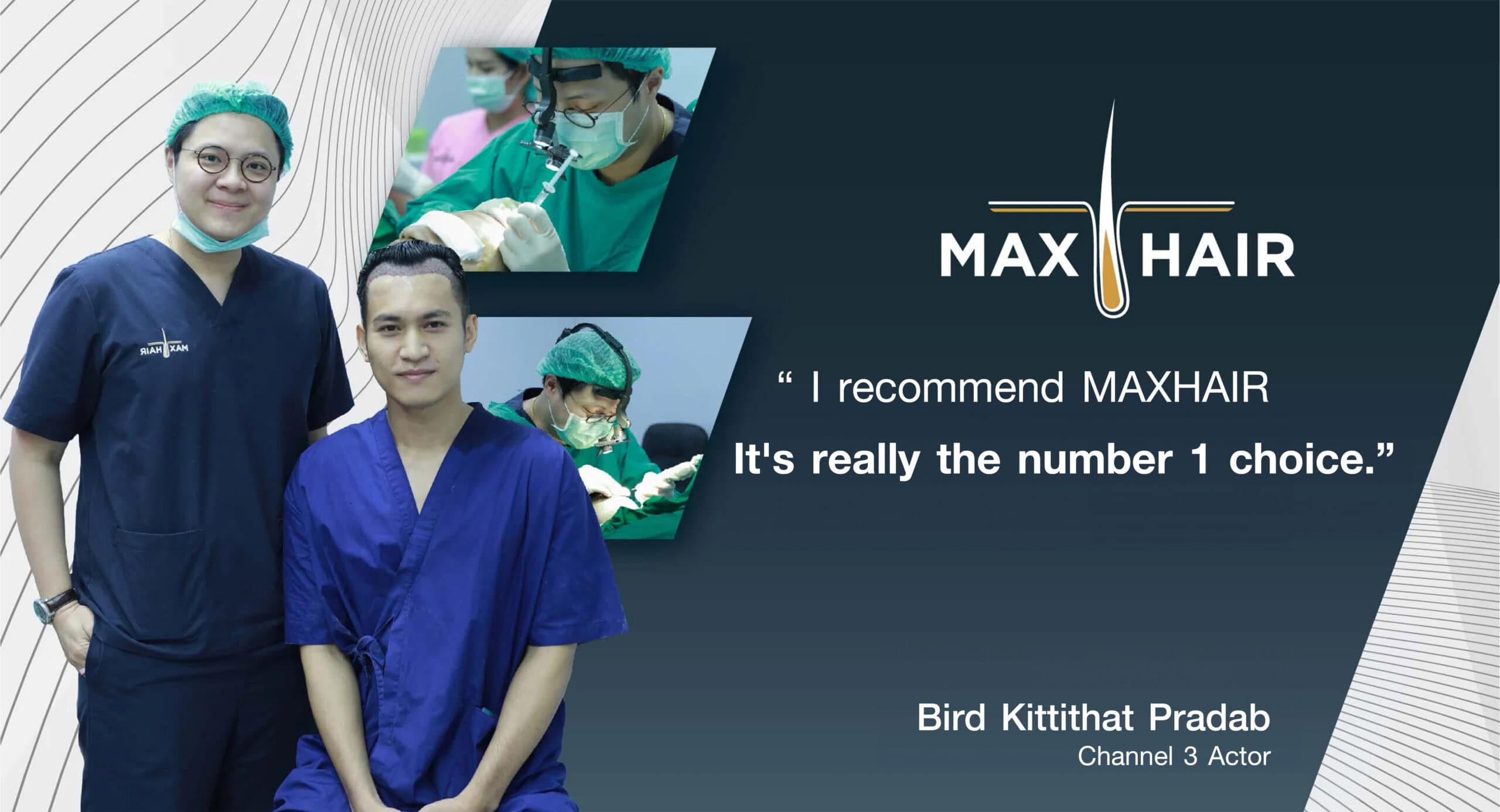 Testimonial for Max Hair Thailand from Bird Kittithat Pradab