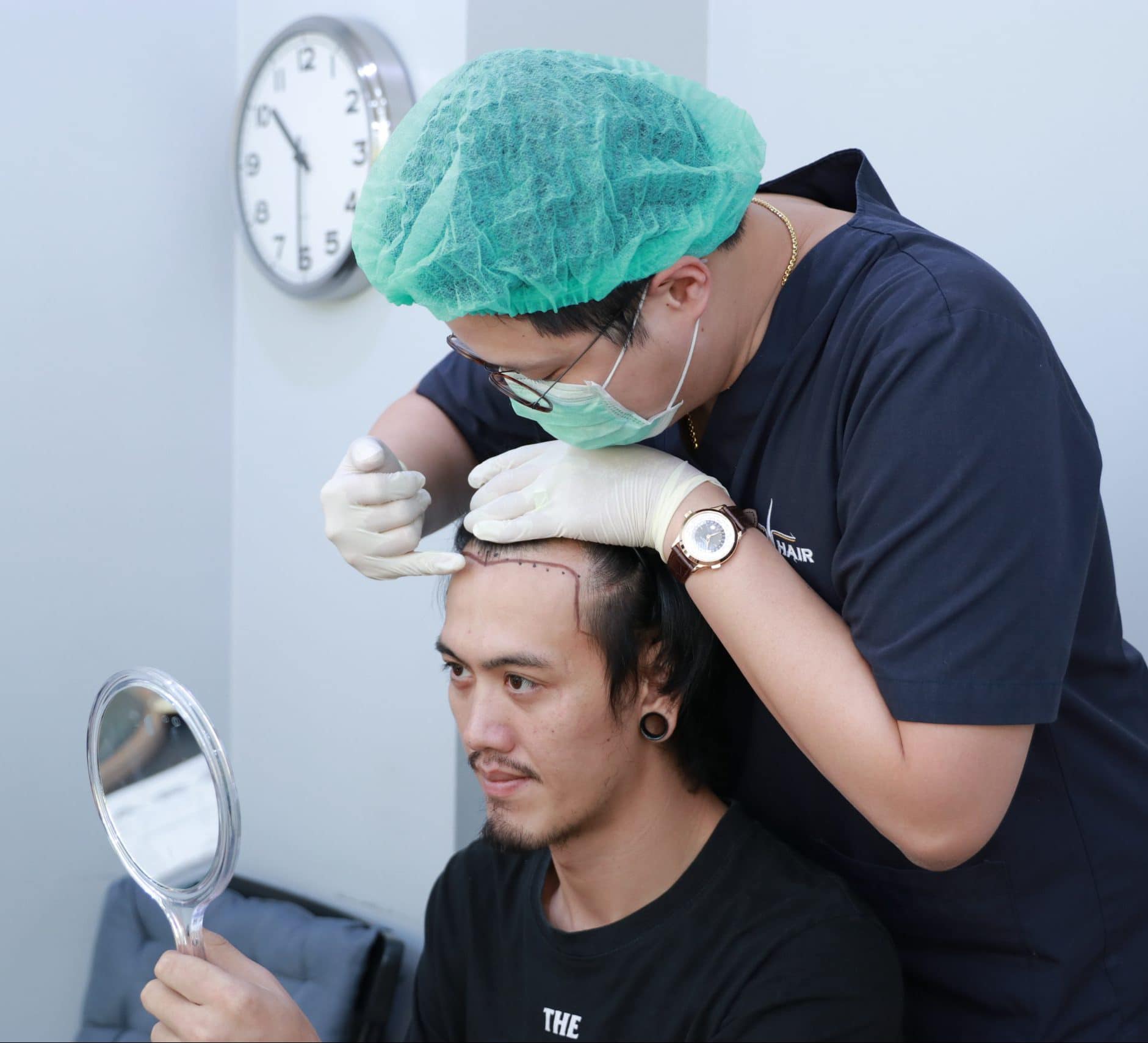 รีวิวปลูกผม คุณทาร์ท อรรถพล ศรีสวัสดิ์ชัย (นักร้องนำ วง ทีที)