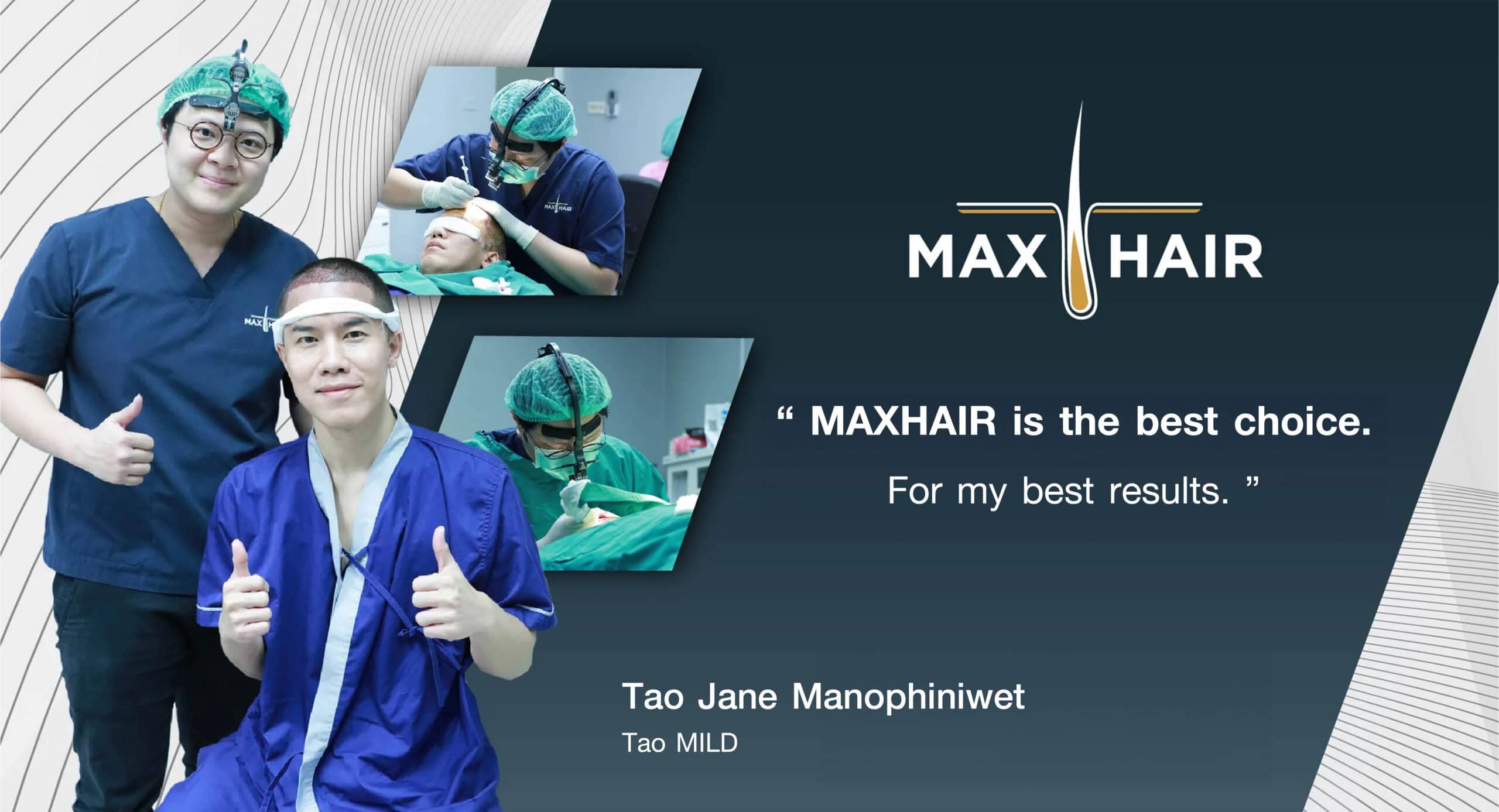 Testimonial for Max Hair Thailand from Tao Jane Manophiniwet