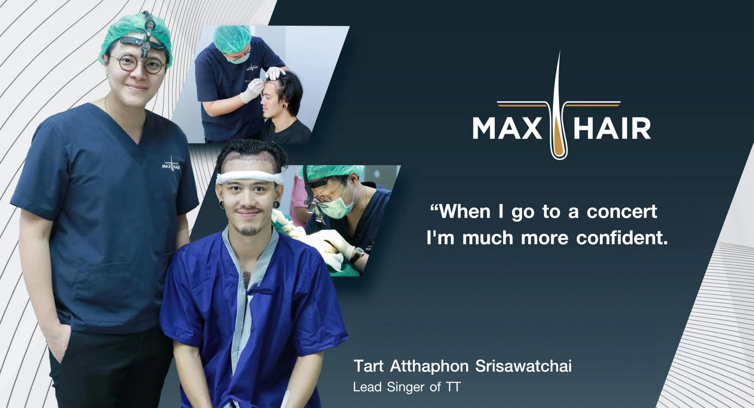 Testimonial for Max Hair Thailand from Tart Atthaphon Srisawatchai