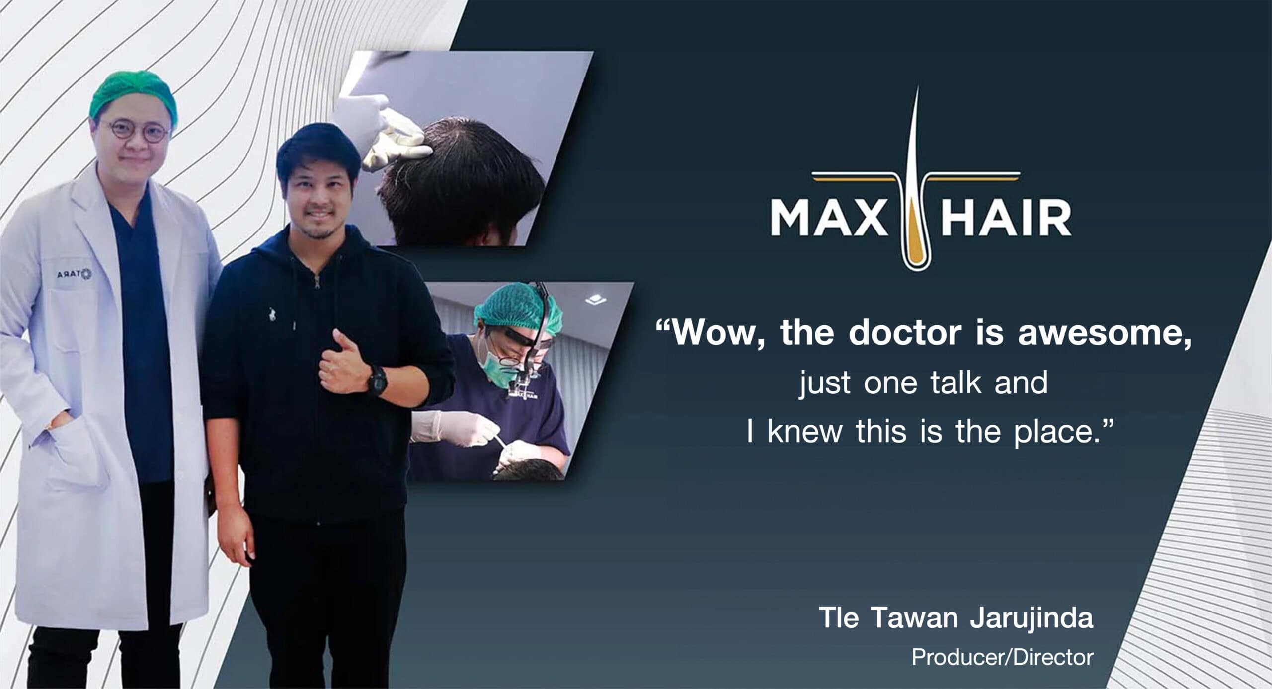 Testimonial for Max Hair Thailand from Tle Tawan Jarujinda
