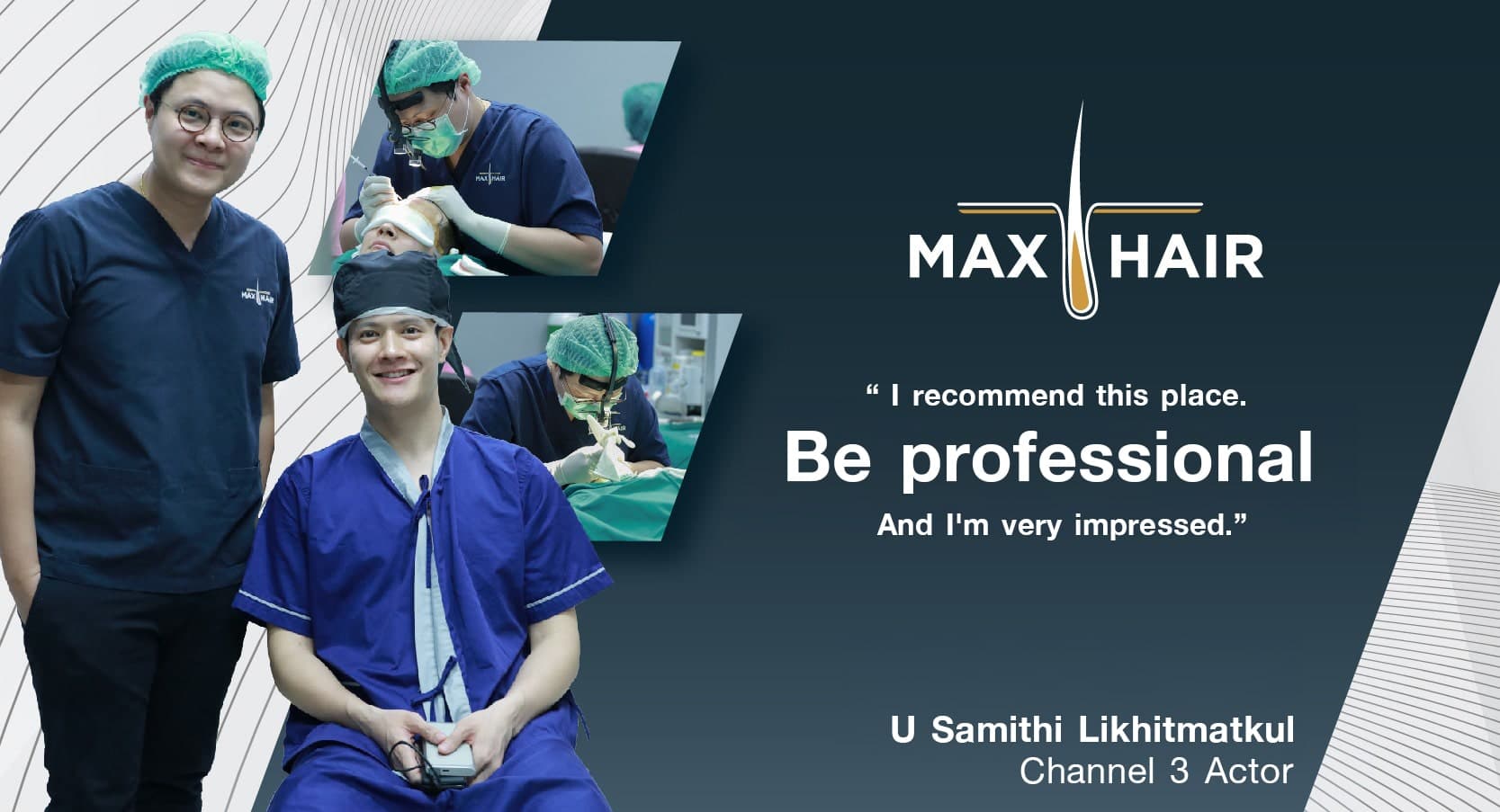 Hair transplant review - U Samithi Likhitmatkul (Channel 3 Actor)
