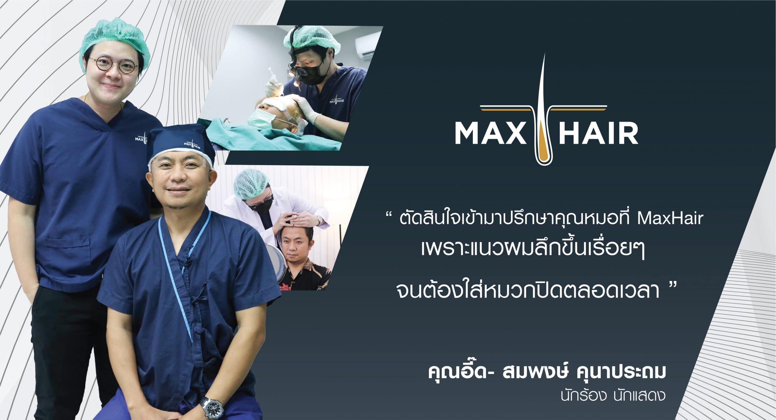 คุณอี๊ด โปงลางสะออน ผู้ใช้บริการปลูกผมที่ MAX-HAIR