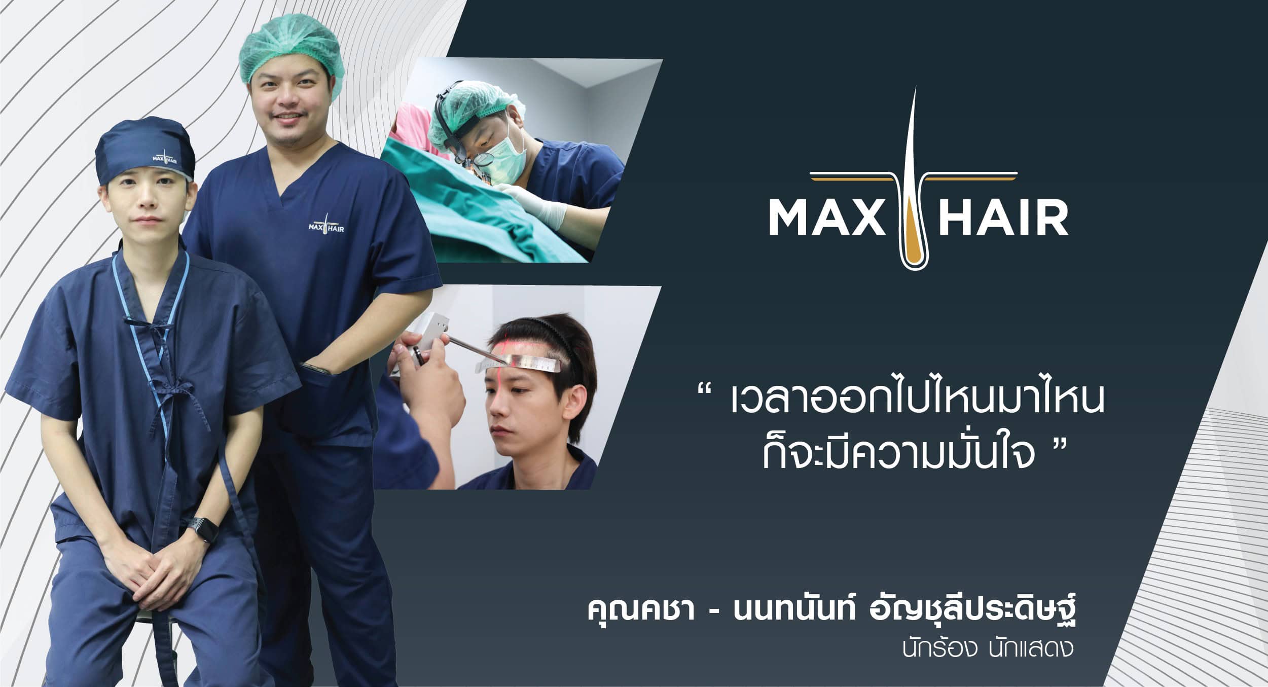 เคสรีวิวปลูกผมคุณคชา นนทนันท์