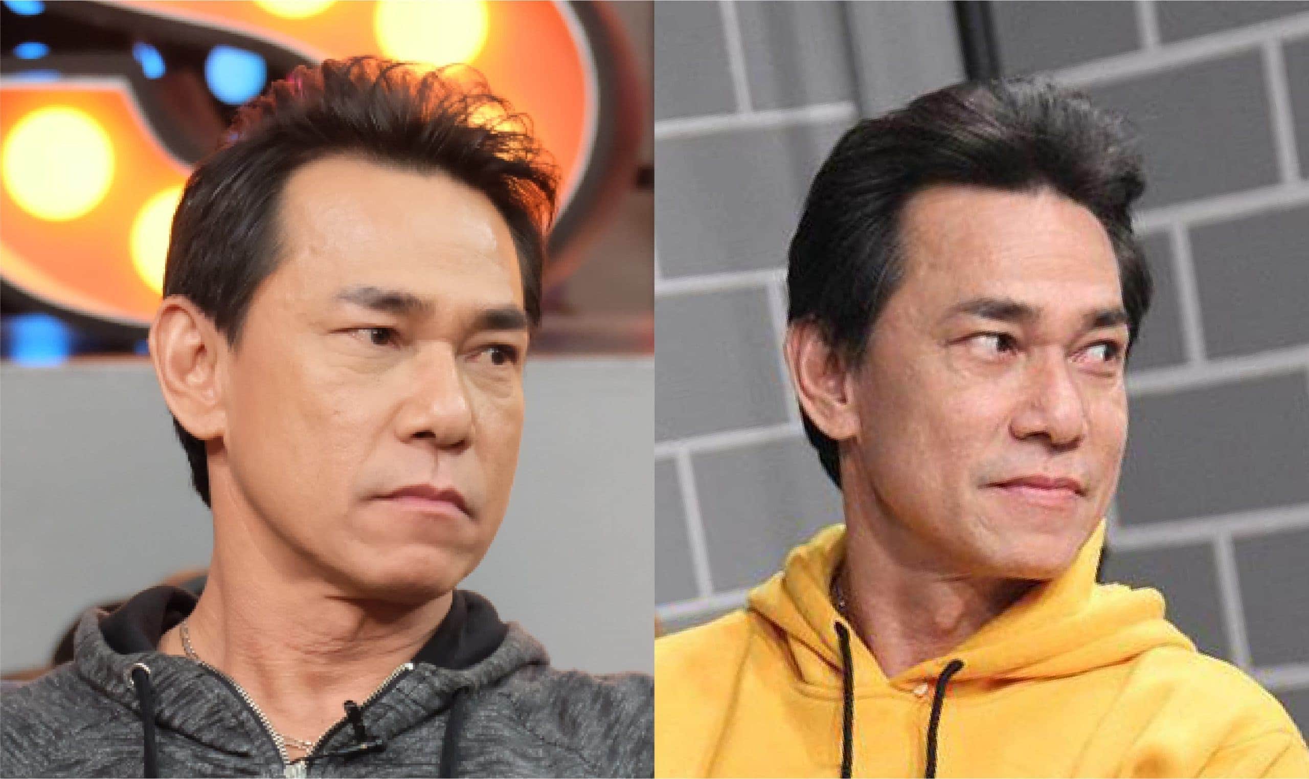 รีวิวการเปลี่ยนแปลงหลังปลูกผมถาวรของตี๋ ดอกสะเดา