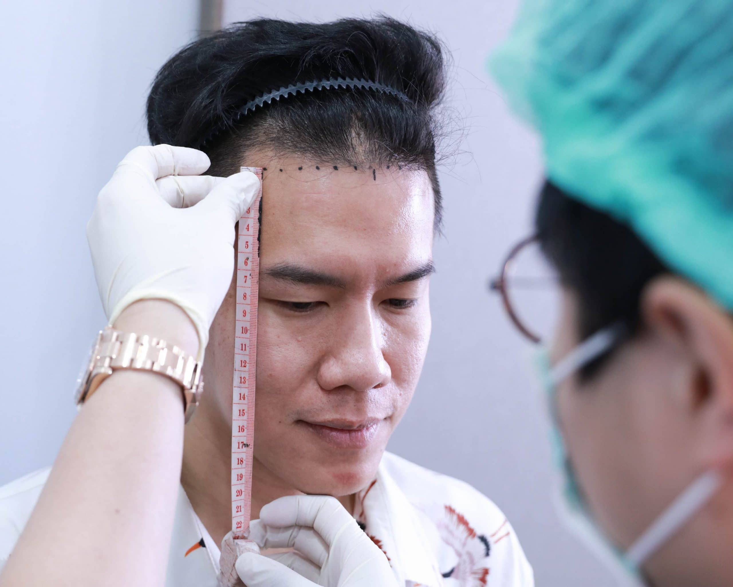 แพทย์กำลังเตรียมการปลูกผมถาวรให้คุณเต่า เจน มโนภินิเวศ