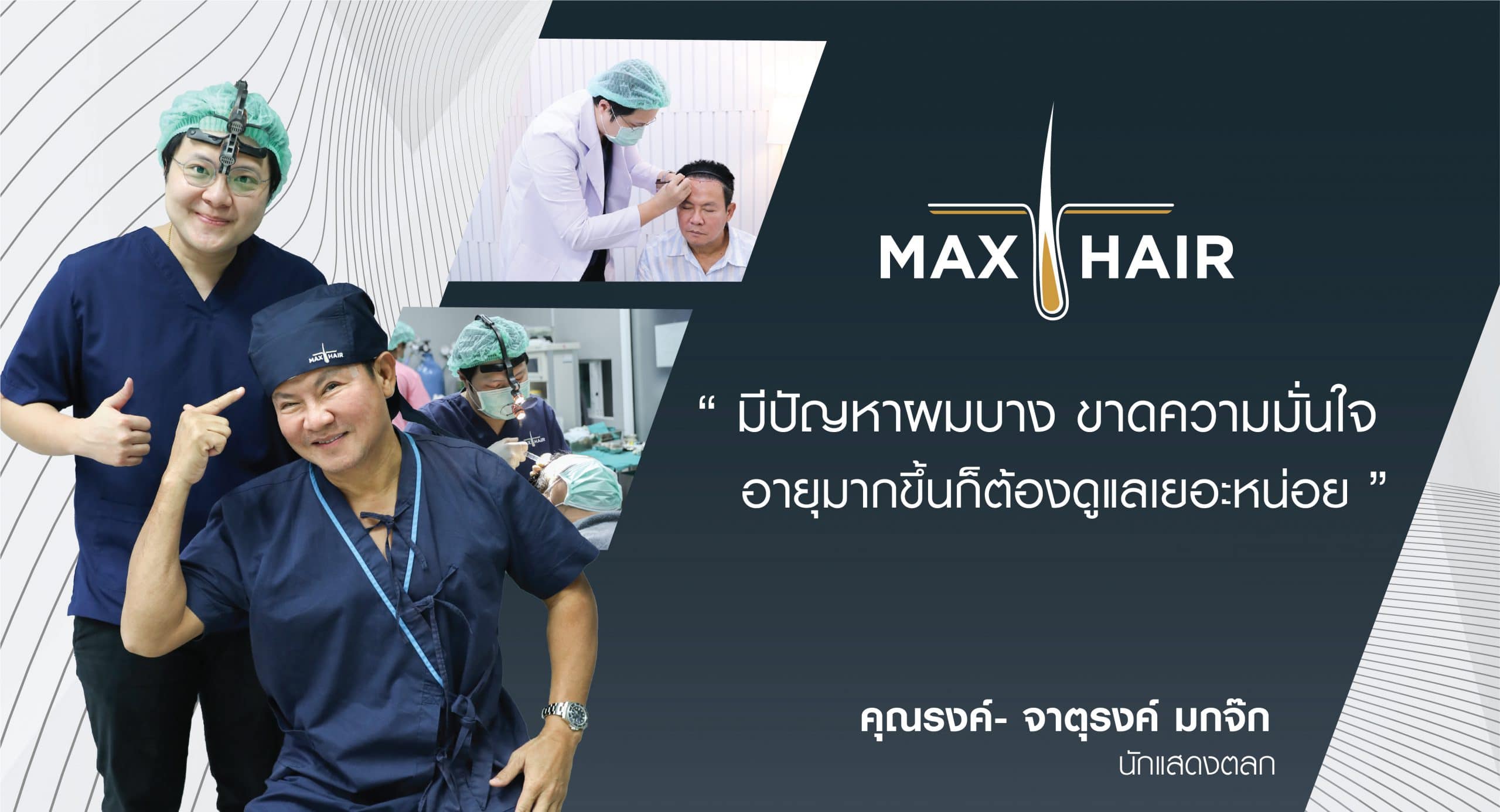 รีวิวปลูกผมผู้ชายเคสคุณจาตุรงค์ มกจ๊ก (นักแสดงตลก)