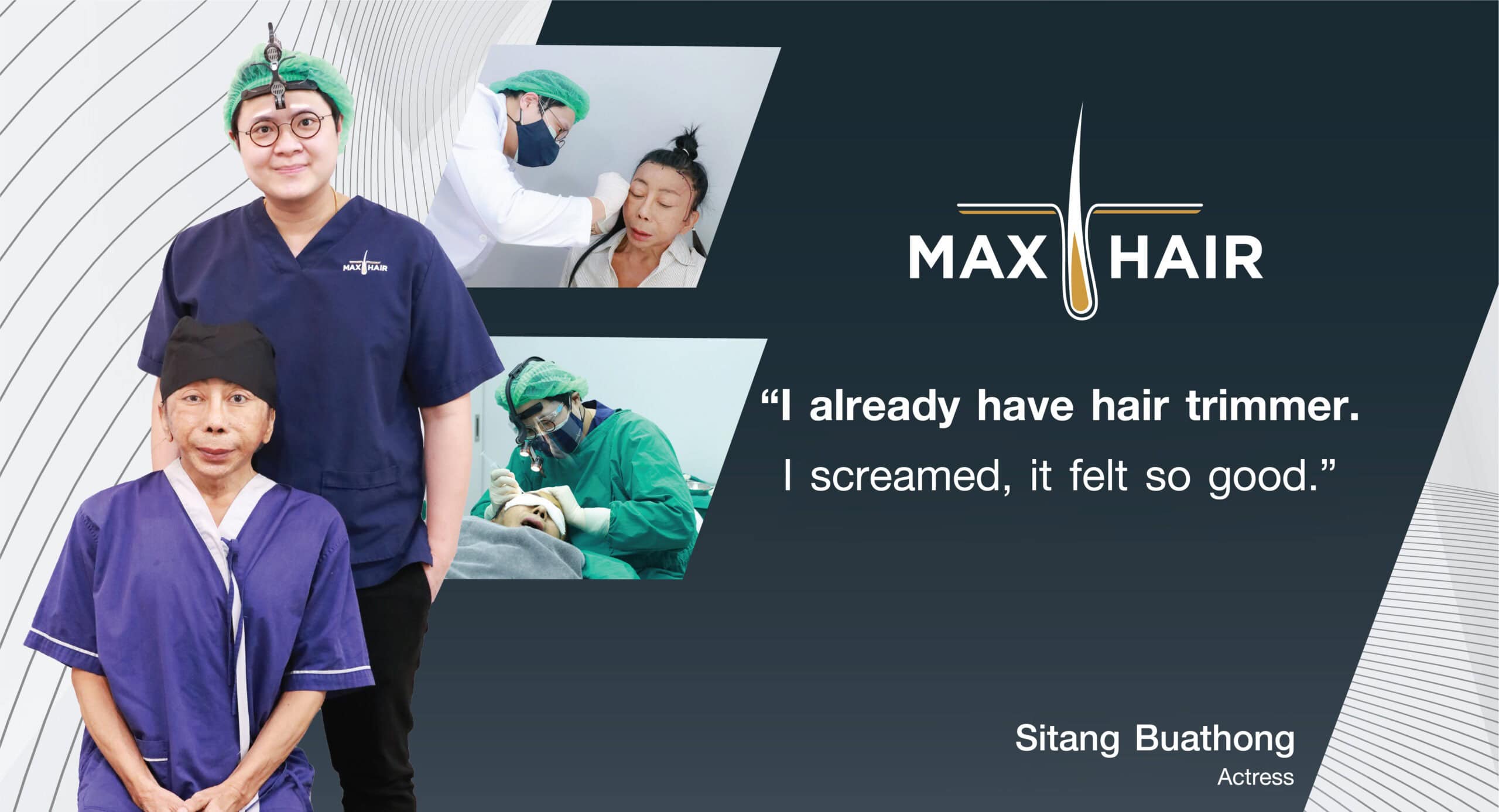 Testimonial for Max Hair Thailand from Sitang Buathong